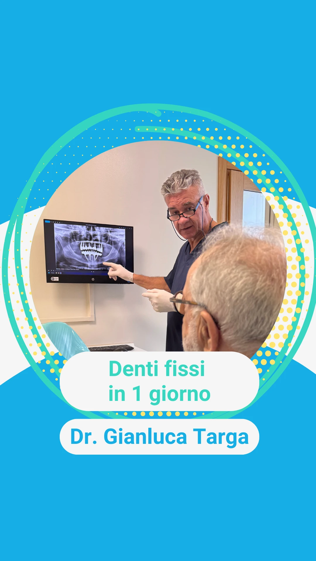 Impianto dentale a Rovigo