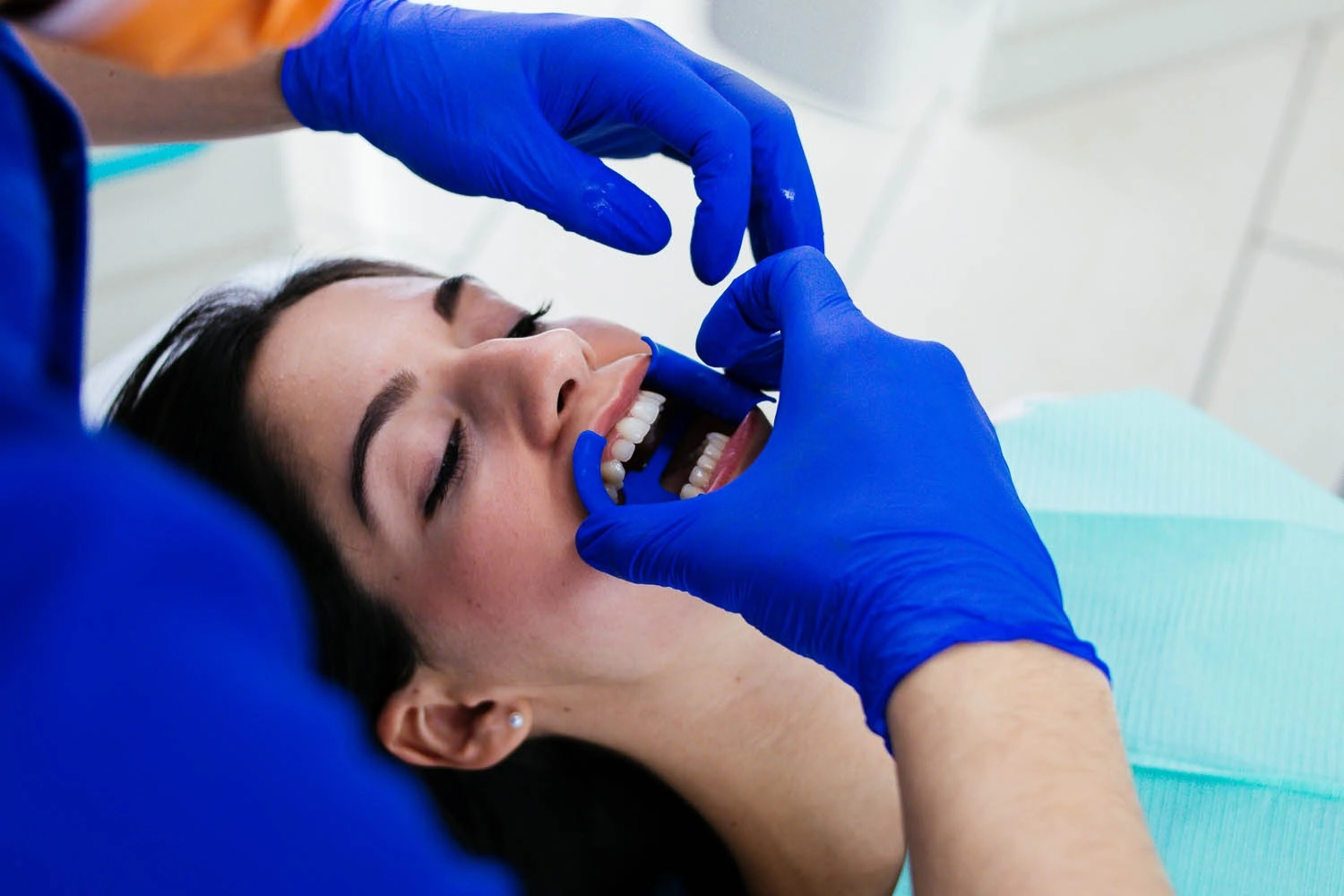 Lo sbiancamento dentale è realtà 1 Sbiancamento dentale